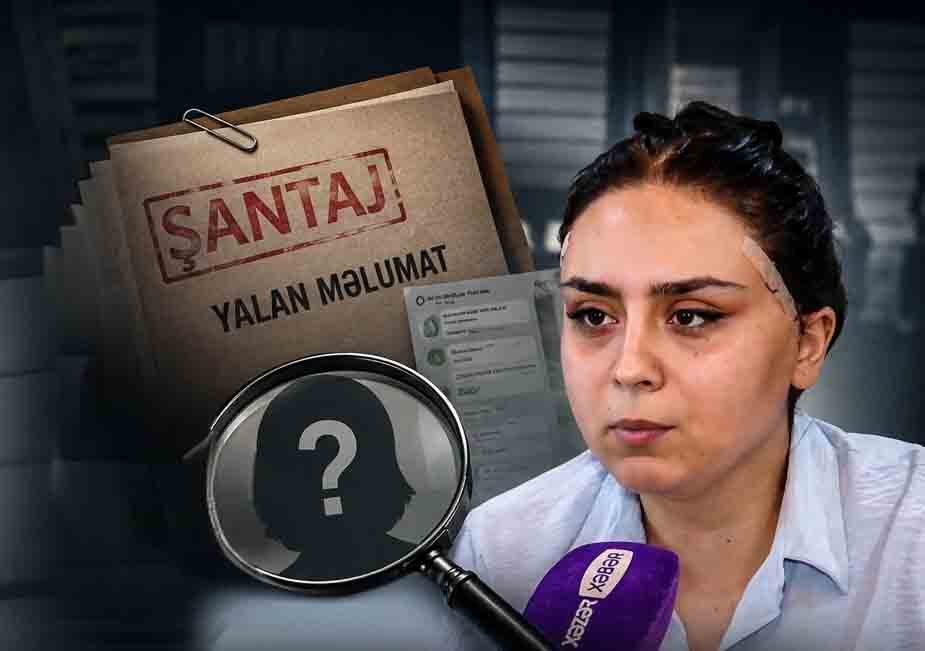 Temporal üz gərmə əməliyyatı ətrafında yaranan mübahisələr: Tibbi faktlar nə deyir?